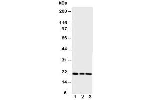 Western blot testing of PBP antibody and Lane 1:  rat brain (PEBP1 anticorps  (N-Term))