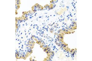 Immunohistochemistry of paraffin-embedded mouse lung using PIP4K2B antibody at dilution of 1:100 (x40 lens). (PIP4K2B anticorps)