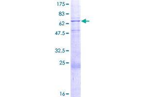 Image no. 1 for Pyruvate Dehydrogenase Kinase, Isozyme 3 (PDK3) (AA 1-406) protein (GST tag) (ABIN1314553)
