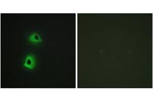 Immunofluorescence analysis of HeLa cells, using T3JAM Antibody.