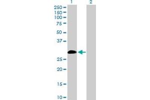 Western Blot analysis of IL9 expression in transfected 293T cell line by IL9 MaxPab polyclonal antibody. (IL-9 anticorps  (AA 1-144))