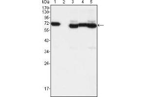 Western blot analysis using TCF3 mouse mAb against A549 (1), A431 (2), Hela (3), PANC-1 (4) and PC-3 (5) cell lysate.