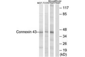 Western blot analysis of extracts from MCF-7/COS7/Mouse Heart, using Connexin 43 (Ab-367) Antibody. (Connexin 43/GJA1 anticorps  (AA 332-381))