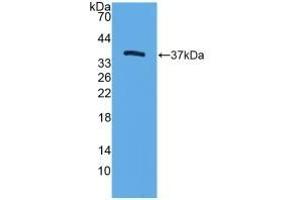 Detection of Recombinant TFF3, Mouse using Polyclonal Antibody to Trefoil Factor 3 (TFF3)