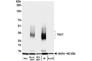 Western Blotting (WB) image for anti-T Cell Immunoreceptor with Ig and ITIM Domains (TIGIT) (AA 194-244) antibody (ABIN7449559)