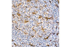 Immunohistochemistry of paraffin-embedded Human tonsil (positive control antibody staining, clone 55k-2) using Fascin/FSCN1 antibody (ABIN7267142) at dilution of 1:100 (40x lens). (Fascin anticorps)