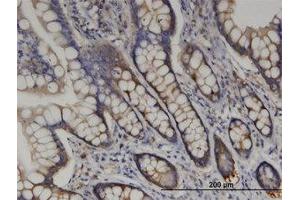 Image no. 2 for anti-Arginyl-tRNA Synthetase (RARS) (AA 1-661) antibody (ABIN599427) (RARS anticorps  (AA 1-661))
