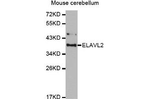 Western Blotting (WB) image for anti-ELAV (Embryonic Lethal, Abnormal Vision, Drosophila)-Like 2 (Hu Antigen B) (ELAVL2) antibody (ABIN1876947) (ELAVL2 anticorps)