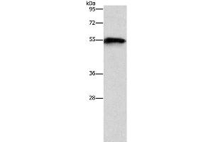 Western Blot analysis of Mouse heart tissue using CDK19 Polyclonal Antibody at dilution of 1:1000 (CDK19 anticorps)