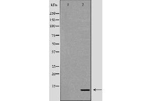 Western blot analysis of Hela whole cell lysates, using RBX1 Antibody. (RBX1 anticorps  (C-Term))