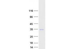 Validation with Western Blot