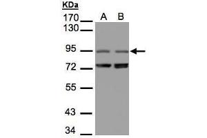WB Image Sample(30 μg of whole cell lysate) A:293T B:Raji, 7. (NIR1 anticorps  (C-Term))