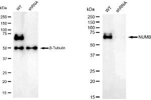 Western blotting analysis using NUMB antibody (ABIN7799692). (Recombinant NUMB anticorps)