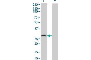 Western Blot analysis of RAD1 expression in transfected 293T cell line by RAD1 monoclonal antibody (M01A), clone 1G2. (RAD1 anticorps  (AA 1-90))