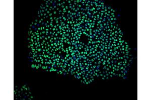 Immunoflourescent staining of Nanog in human embryonic stem cells. (Nanog anticorps)