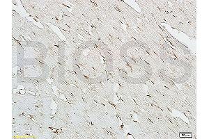 Formalin-fixed and paraffin embedded: rat heart tissue labeled with Anti-NOS-3/eNOS Polyclonal Antibody (ABIN725690), Unconjugated at 1:200 followed by conjugation to the secondary antibody and DAB staining