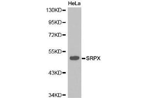 Western Blotting (WB) image for anti-Sushi-Repeat Containing Protein, X-Linked (SRPX) (AA 40-320) antibody (ABIN6215763) (SRPX anticorps  (AA 40-320))