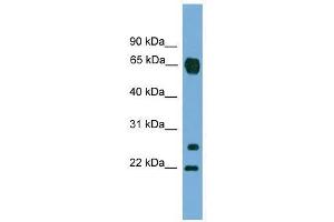 MMP26 antibody used at 0. (MMP26 anticorps  (C-Term))