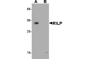 Western blot analysis of RILP in HeLa cell lysate with RILP antibody at 1 µg/mL in (A) the absence and (B) the presence of blocking peptide. (RILP anticorps  (Middle Region))