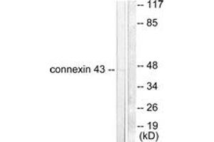Western blot analysis of extracts from A549 cells, using Connexin 43 Antibody. (Connexin 43/GJA1 anticorps  (AA 333-382))