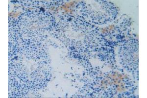 IHC-P analysis of Mouse Testis Tissue, with DAB staining. (MAPT anticorps  (AA 92-400))