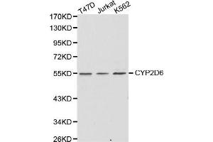 Western Blotting (WB) image for anti-Cytochrome P450, Family 2, Subfamily D, Polypeptide 6 (CYP2D6) (AA 20-230) antibody (ABIN6216807) (CYP2D6 anticorps  (AA 20-230))