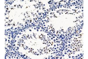 ABIN6259773 and ABIN6279079 at 1/100 staining mouse testis tissue by IHC-P. (ADAM30 anticorps  (Internal Region))