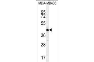 ALX4 Antibody (Center) (ABIN654344 and ABIN2844113) western blot analysis in MDA-M cell line lysates (35 μg/lane). (ALX4 anticorps  (AA 249-275))