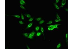 Immunofluorescent analysis of Hela cells using ABIN7168329 at dilution of 1:100 and Alexa Fluor 488-congugated AffiniPure Goat Anti-Rabbit IgG(H+L) (RBM10 anticorps  (AA 501-700))