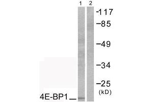 Western Blotting (WB) image for anti-Eukaryotic Translation Initiation Factor 4E Binding Protein 1 (EIF4EBP1) (Thr70) antibody (ABIN1847930) (eIF4EBP1 anticorps  (Thr70))
