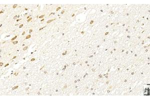 Immunohistochemical analysis of paraffin-embedded Human brain section using LINGO-1(LRRN6A)- (C-term) Antibody (ABIN651289 and ABIN2840172).