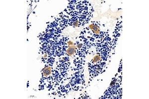 Immunohistochemistry of paraffin embedded mouse bone using TREML1 (ABIN7076009) at dilution of 1:2200 (400x lens) (TREML1 anticorps)