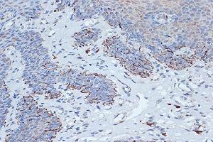 Immunohistochemistry of paraffin-embedded human esophageal using STK3/MST2 Rabbit mAb (ABIN7270223) at dilution of 1:100 (40x lens).