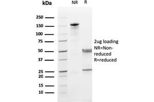 SDS-PAGE Analysis Purified CD5 Mouse Monoclonal Antibody (CD5/2419). (CD5 anticorps  (AA 269-366))