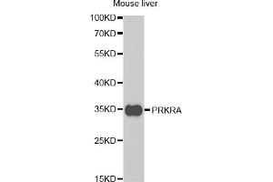 Western blot analysis of extracts of mouse liver, using PRKRA antibody (ABIN5973144) at 1/1000 dilution. (PRKRA anticorps)