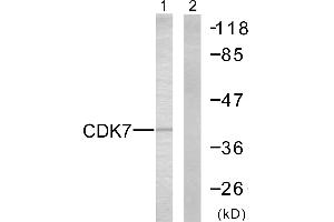 Immunohistochemistry analysis of paraffin-embedded human lung carcinoma tissue using CDK7 antibody. (CDK7 anticorps  (Internal Region))