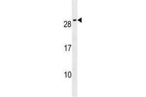 CFC1B antibody western blot analysis in NCI-H292 lysate (CFC1B anticorps  (AA 20-48))