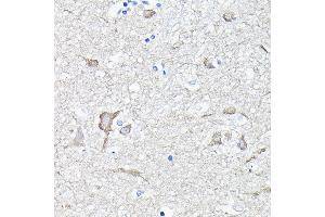 Immunohistochemistry of paraffin-embedded human brain using EEF1 Rabbit pAb (ABIN6129010, ABIN6139947, ABIN6139948 and ABIN6223167) at dilution of 1:100 (40x lens).
