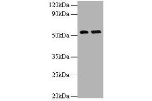 Western blot All lanes: MMP12 antibody at 2 μg/mL Lane 1: Hela whole cell lysate Lane 2: NIH/3T3 whole cell lysate Secondary Goat polyclonal to rabbit IgG at 1/10000 dilution Predicted band size: 55 kDa Observed band size: 55 kDa (MMP12 anticorps  (AA 109-470))