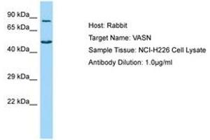 Image no. 1 for anti-Vasorin (Vasn) (AA 521-570) antibody (ABIN6750146) (Vasn anticorps  (AA 521-570))