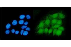 IF analysis of DHPS/DHS using anti-DHPS/DHS antibody (ABIN7601998). (DHPS anticorps  (AA 54-358))