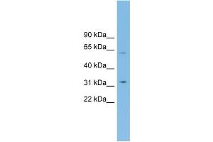 WB Suggested Anti-SLC39A9 Antibody Titration: 0. (SLC39A9 anticorps  (Middle Region))