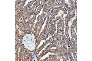 IHC analysis of SFXN3 using anti-SFXN3 antibody (ABIN7601302). (SFXN3 anticorps  (AA 32-321))