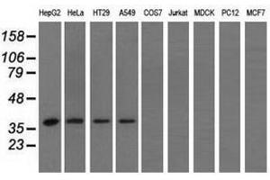 Image no. 2 for anti-3-hydroxyisobutyryl-CoA Hydrolase (HIBCH) antibody (ABIN1498654)