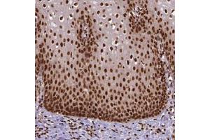 Immunohistochemical staining (Formalin-fixed paraffin-embedded sections) of human esophagus with NACC1 polyclonal antibody  shows nuclear positivity in squamous epithelial cells. (NAC1 anticorps)
