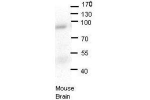 LSS antibody - N-terminal region  validated by WB using Mouse brains at 1:1000. (LSS anticorps  (N-Term))