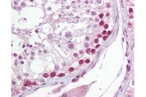 Anti-UNG antibody IHC of human testis.