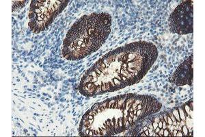 Image no. 9 for anti-Signal Recognition Particle Receptor, B Subunit (SRPRB) antibody (ABIN1501126)