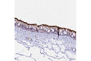 Immunohistochemical staining of human nasopharynx with CCDC19 polyclonal antibody  shows strong positivity in cilia of respiratory epithelial cells at 1:200-1:500 dilution. (CCDC19 anticorps)