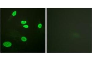 Immunofluorescence analysis of HeLa cells, using Histone H3 (Acetyl-Lys9) Antibody. (Histone 3 anticorps  (H3K9ac))